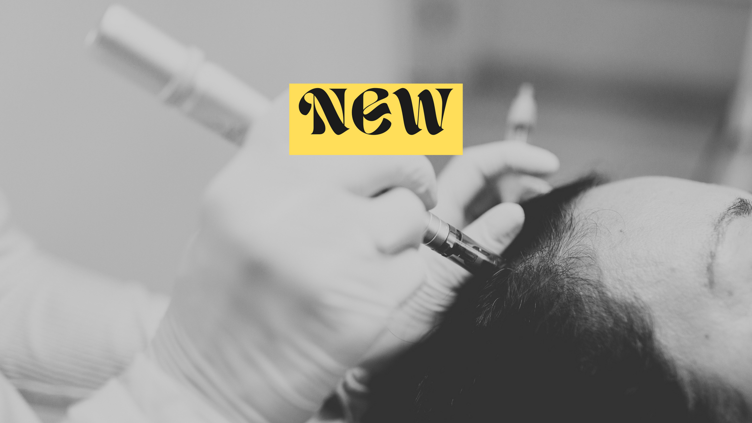 How effective is Microneedling for Hair Growth?