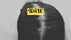 Should I Start Minoxidil for Hair Loss?
