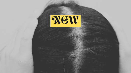 Should I Start Minoxidil for Hair Loss?