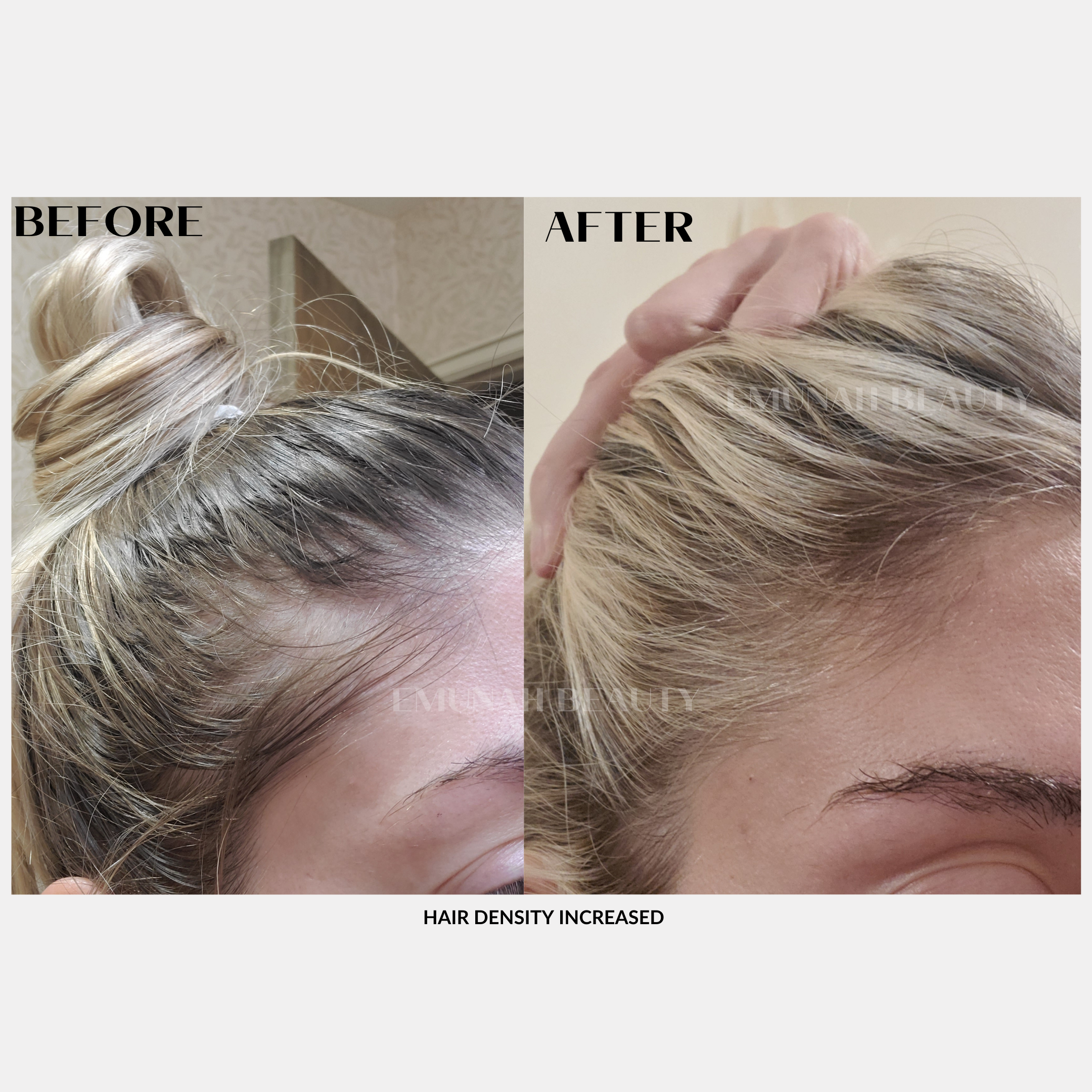 Hair and Scalp Oil
