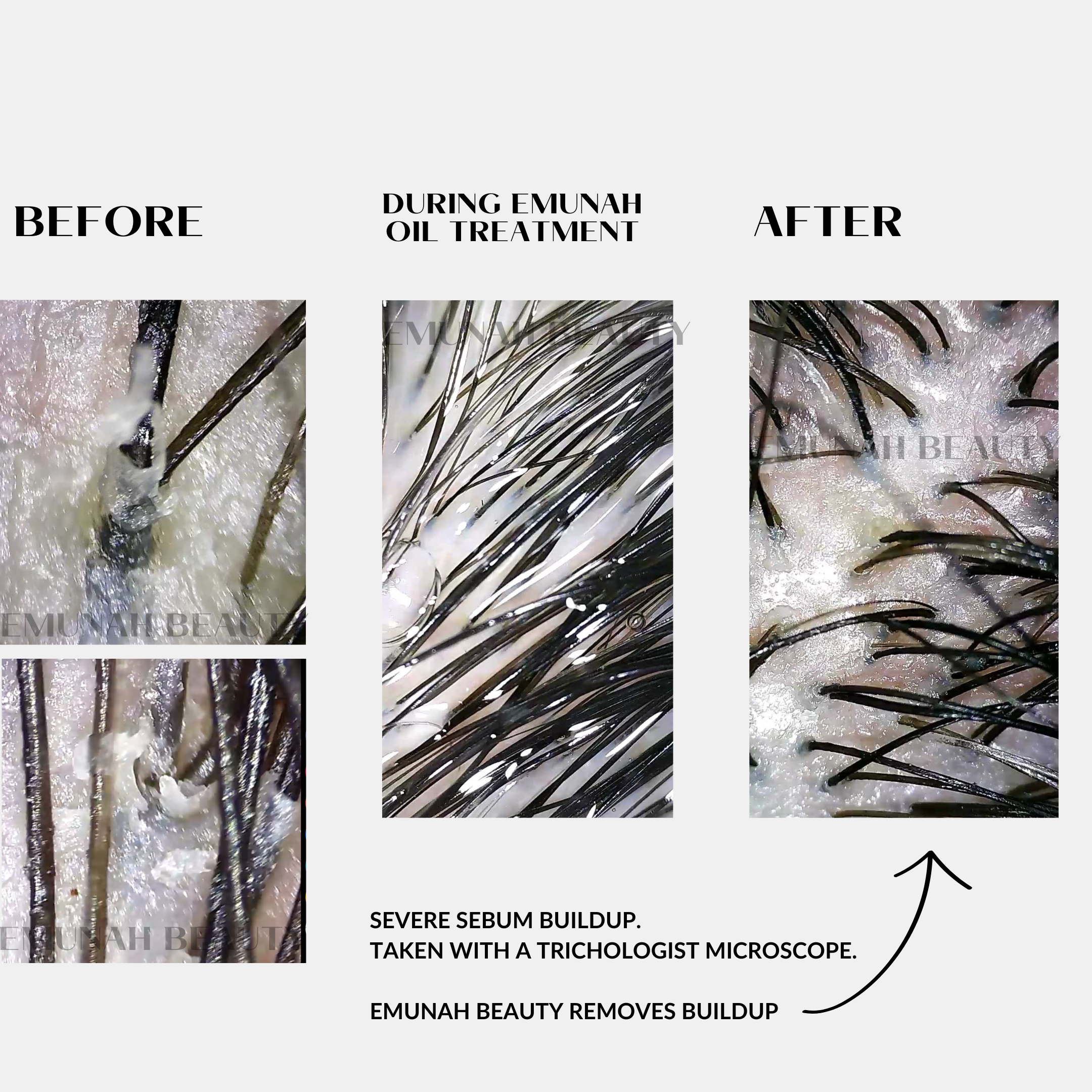 Hair and Scalp Oil