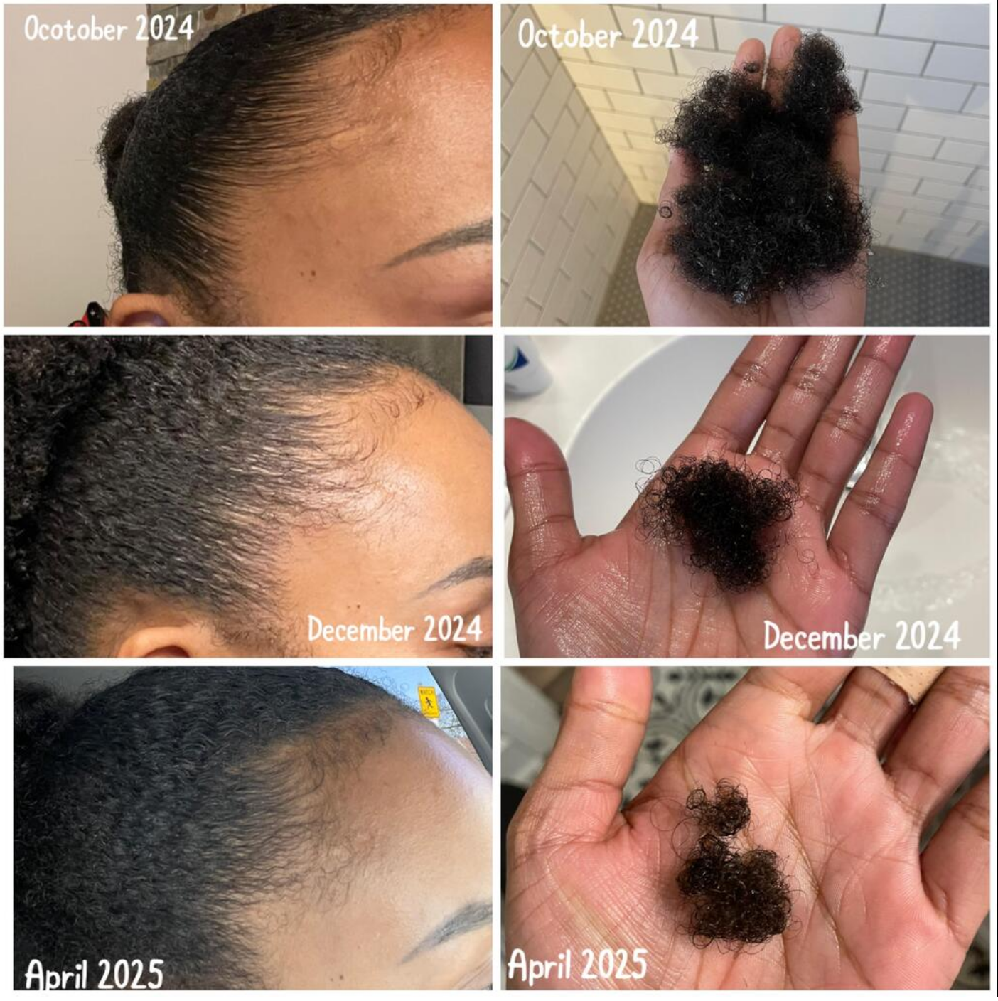 Hair and Scalp Oil